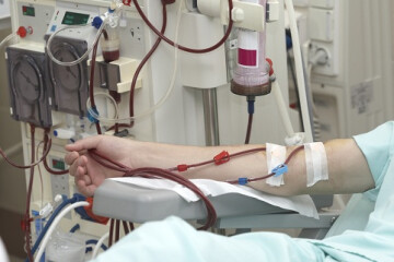 Хворих на ниркову недостатність, які не мають власного авто, возитимуть на процедури за кошти міського бюджету