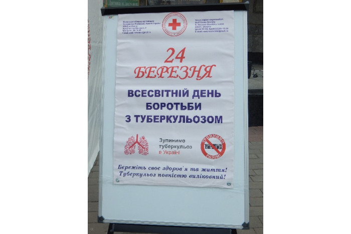 Лучани можуть пройти безкоштовне обстеження на туберкульоз